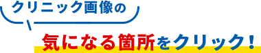 クリック画像の気になる箇所をクリック