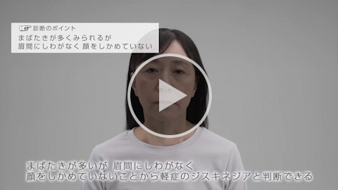 表情筋 軽症 症例2