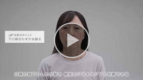 ⼝唇と⼝周辺部 軽症 症例4