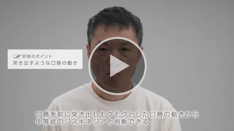 ⼝唇と⼝周辺部 中等症 症例1