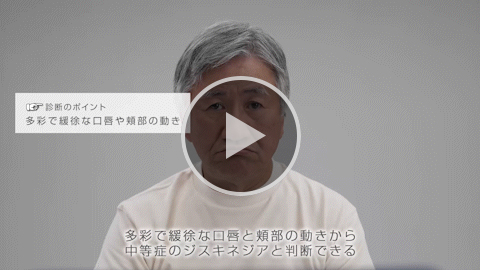 ⼝唇と⼝周辺部 中等症 症例2