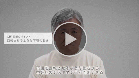 顎 中等症 症例2