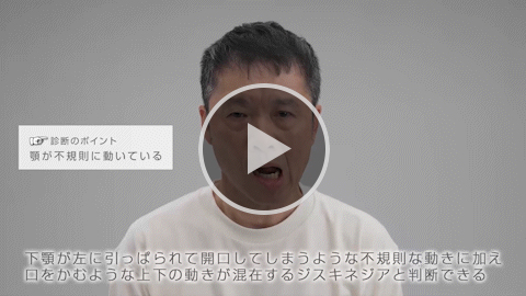 顎 中等症 症例4