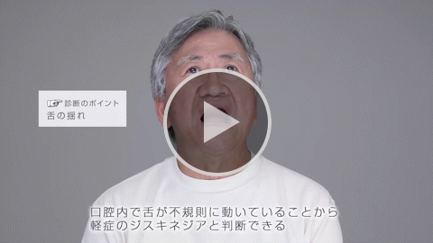 舌 軽症 症例1