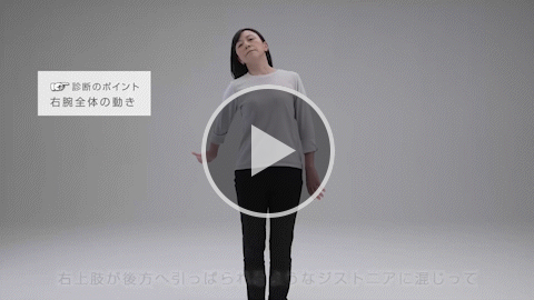 上肢 中等症 症例2