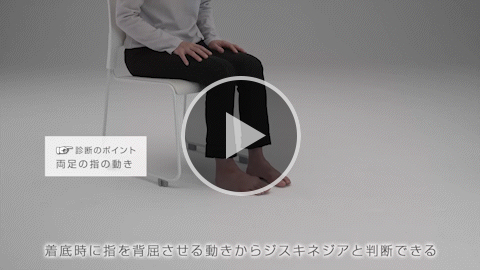 下肢 軽症 症例4